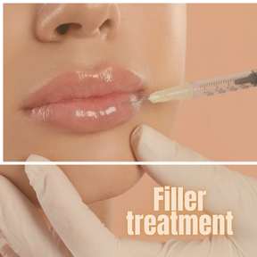 Filler Treatment
