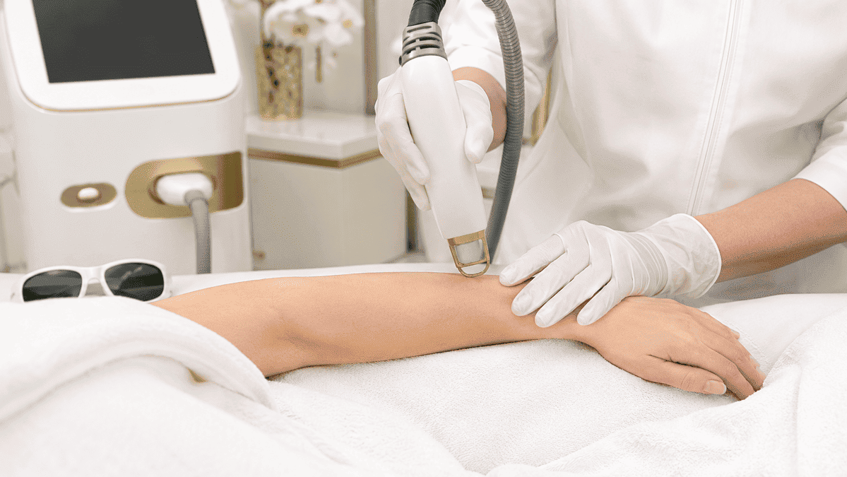 Professional laser hair removal treatment at Derma One Sparkle in Dubai