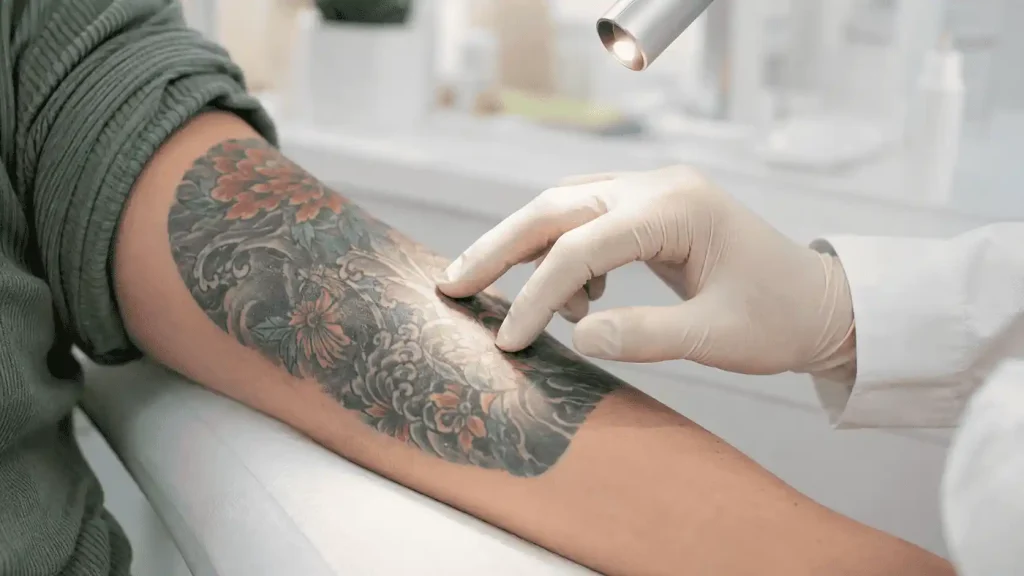 Tattoo colour assessment before laser tattoo removal in Dubai
